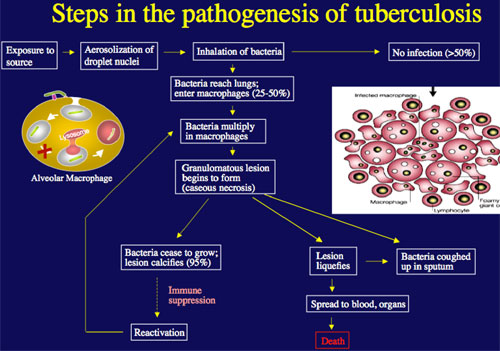 tuberculosis large diagram