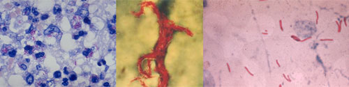 tuberculosis microscopic images