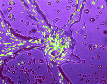 GFP Dictyostelium discoideum or "slime mold"